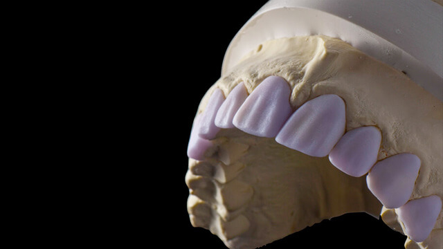 Single Unit Perfection Course