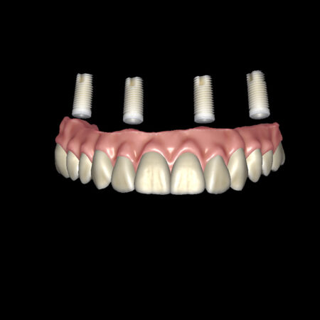 OnX Design Product Image