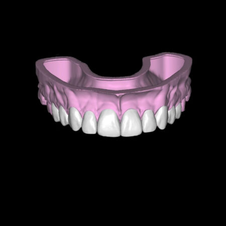 Smile Trial Product Image